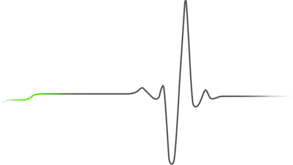 ECG Heartbeat Line Monitor PNG Transparent