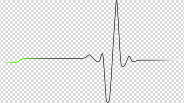 ECG Heartbeat Line Monitor PNG Transparent
